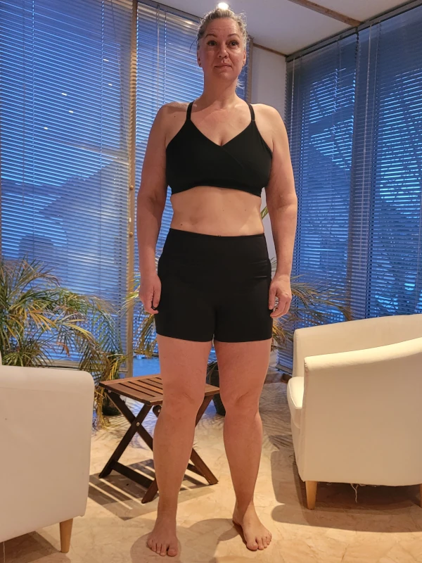 Lucia B. – Nachher