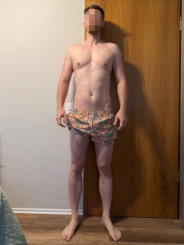 Marius W. – Nachher